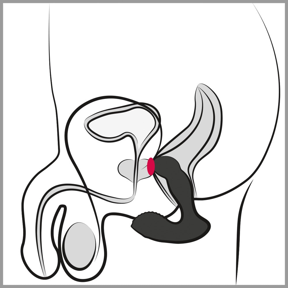 REBEL - RC PROSTATE MASSAGER