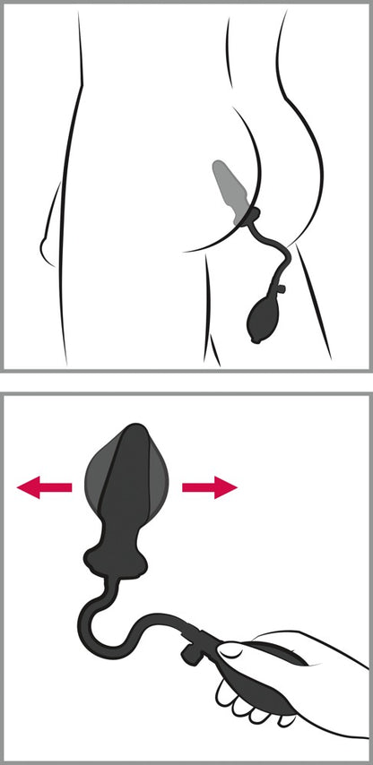 YOU2TOYS - ANAL EXPERT