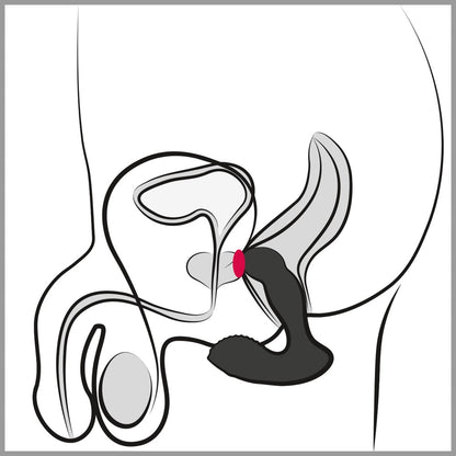 REBEL - RC PROSTATE MASSAGER